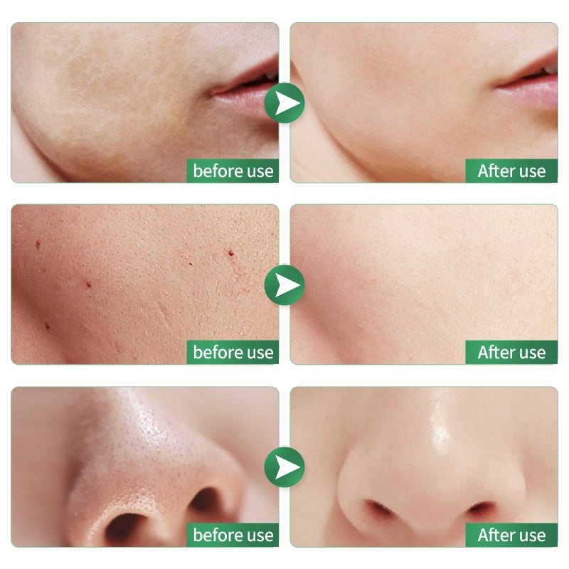 50g Men's Ice Control Exfoliating Peeling Cleanser Oil Deep Cleansing Facial