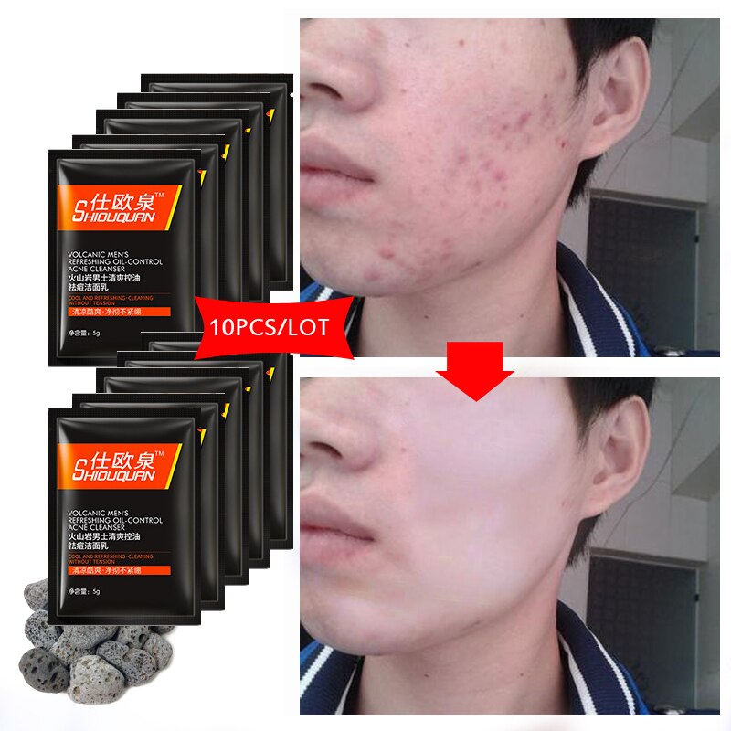 Face Skin Care Washing Men Product Oil-control Moisturizing Facial Cleaner Remove Acne Pore Cleanser Anti Aging Cleansing